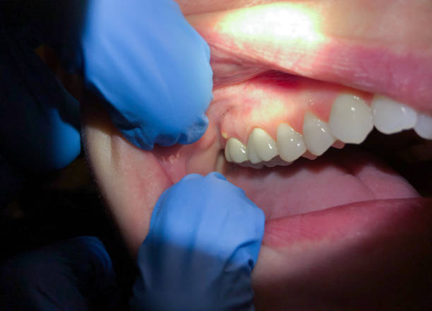 Best Emergency Dentist for Special Needs Patients in Matteson, IL